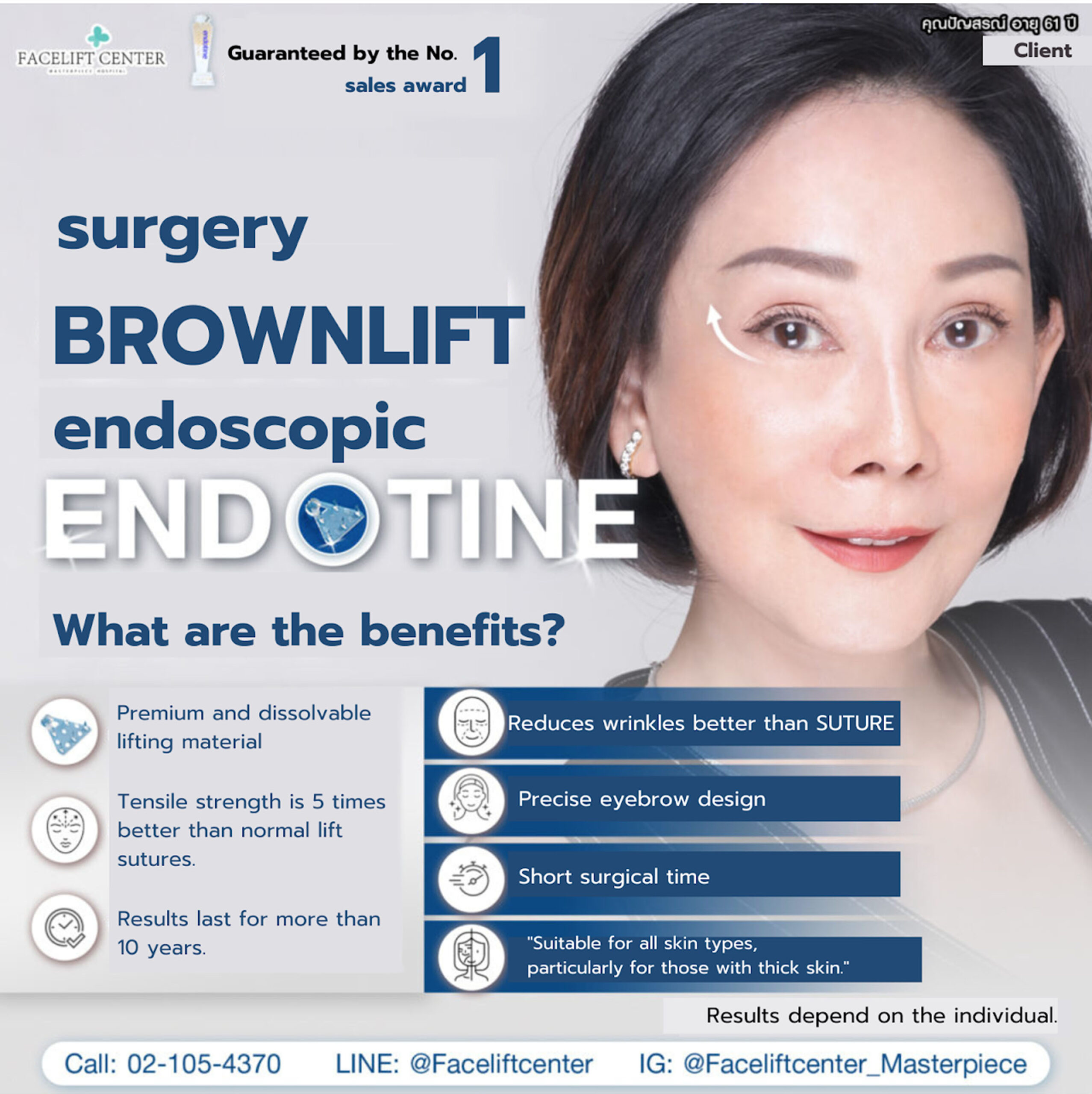 FaceliftandBrowlift4