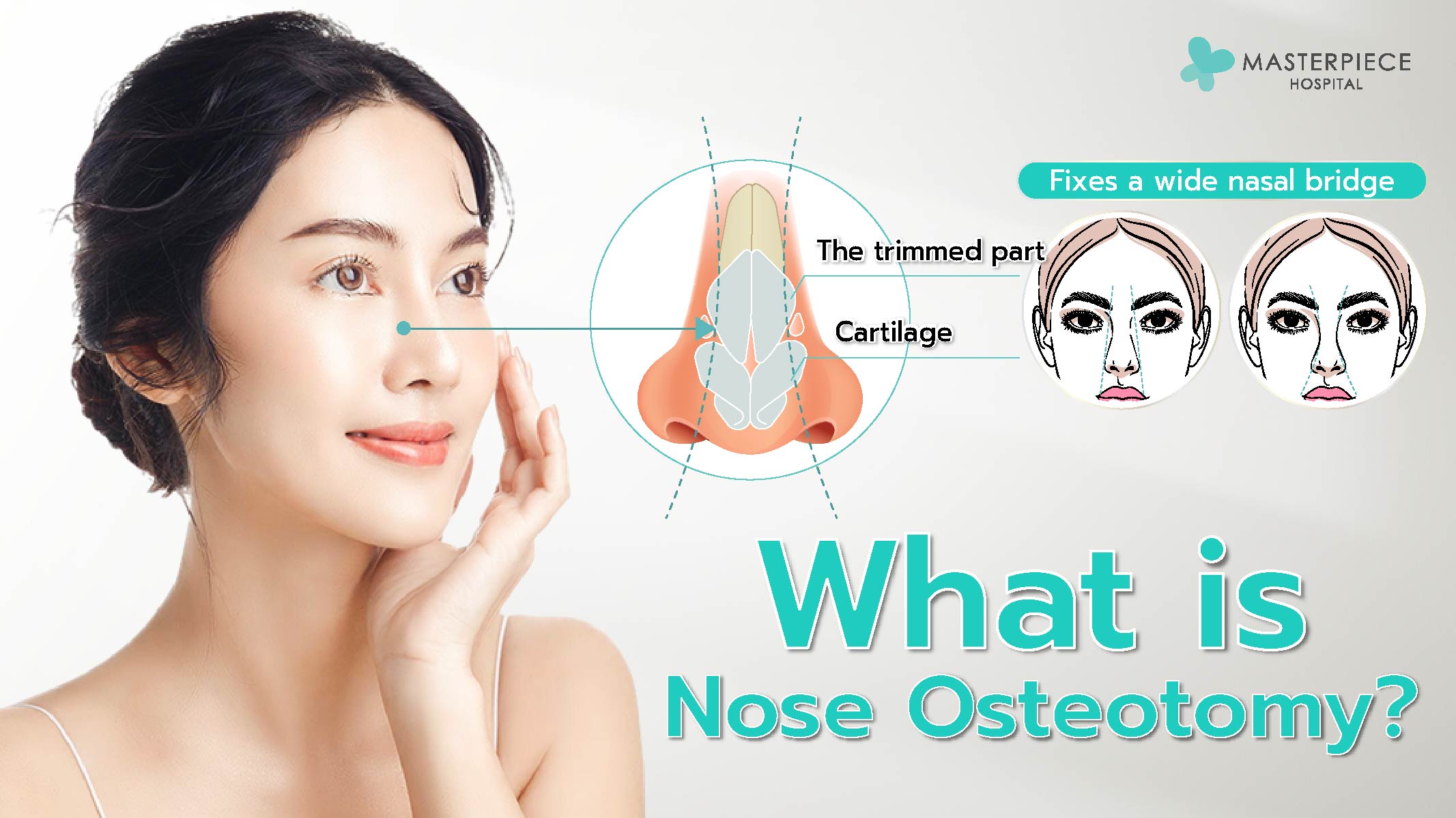 nosesurgery1 Eng-01