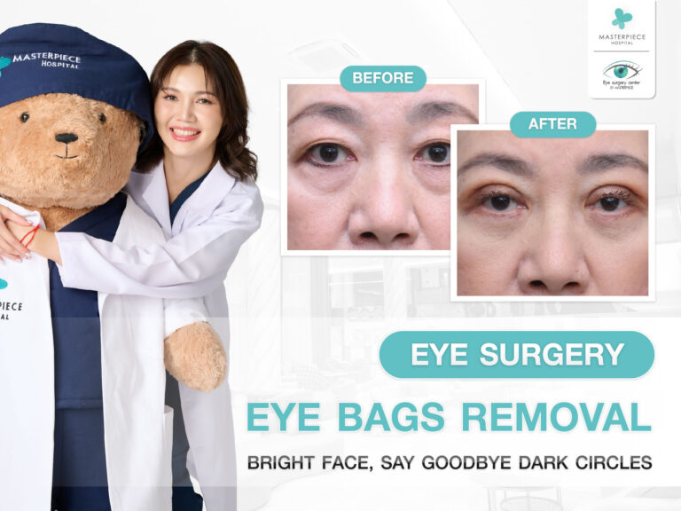 Eye Bags Removal