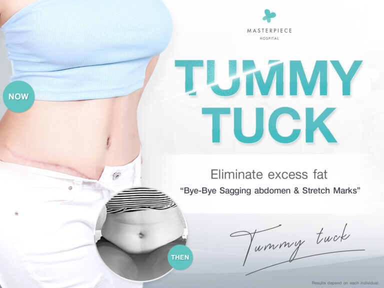 Tummy Tuck: Surgery to fix a flabby tummy