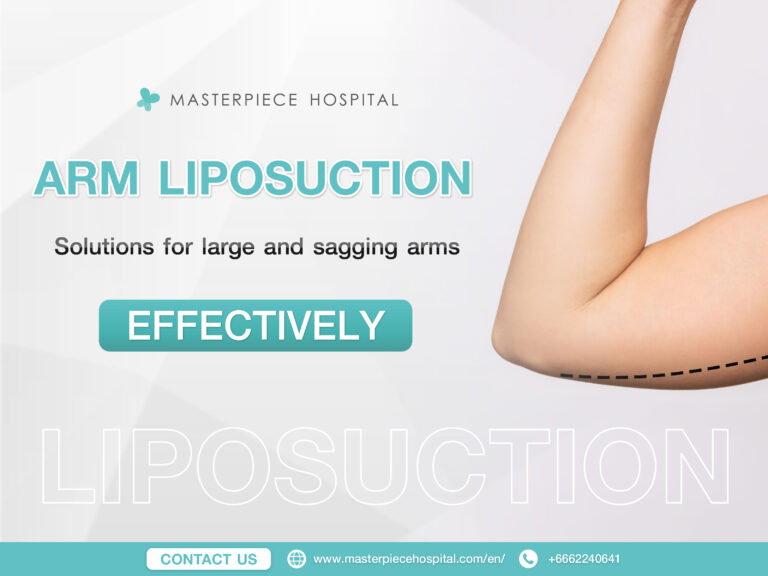 Arm Liposuction: Solve the problem of large or sagging upper arms.