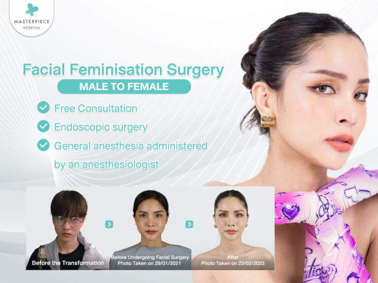 Facial Feminization Surgery: FFS