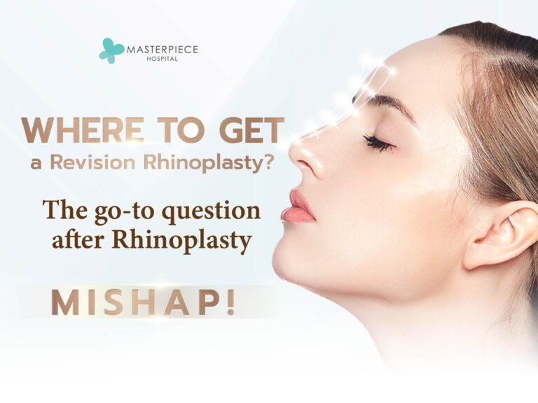 Where’s the best place to get a nose revision? Revision may usually be for correcting mistakes, but even just wanting to change the nose shape is reason enough for a revision.