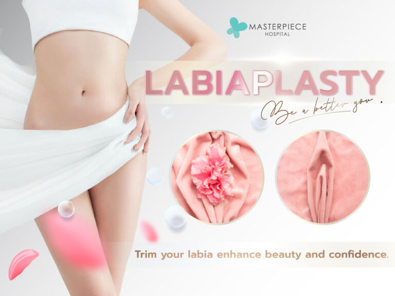 Labiaplasty