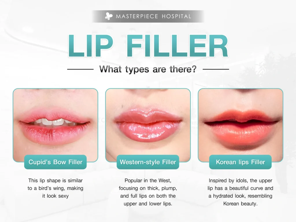 What types of Lip Fillers?