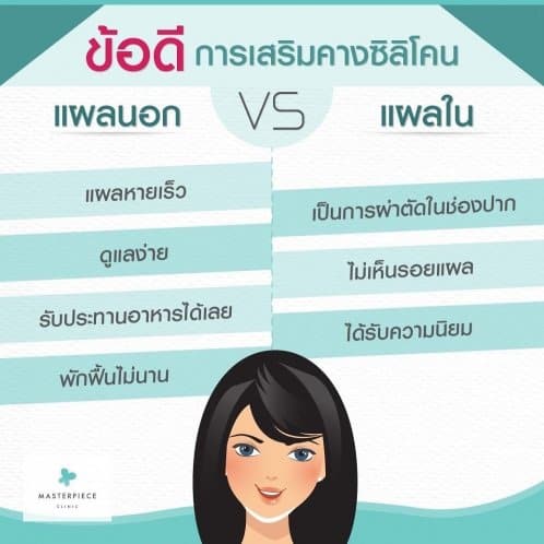 เปรียบเทียบข้อดีการทำคาแบบแผลนอก กับแผลใน