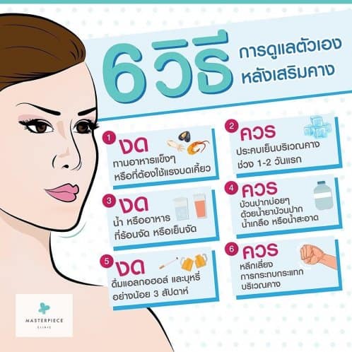 6 วิธีการดูแลตัวเองหลังเสริมคาง 
งดอาหารแข็ง ประคบเย็นช่วย 48 ชั่วโมงแรก งดอาหารหรือน้ำร้อนและเย็นจัด บ้วนน้ำยาหรือเกลือ งดแอลกอฮล์และบุหรี่ เลี่ยงการกระแทกคาง