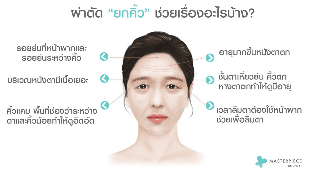 หน้าผู้หญิงมีข้อความอธิบายเรื่องศัลยกรรมยกคิ้วช่วยอะไรได้บ้าง