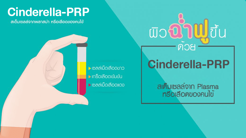 จำลอง Cinderella-PRP เซลล์เม็ดเลือกขาว เกร็ดเลือดเข้มข้น เซลล์เม็ดเลือดแดง