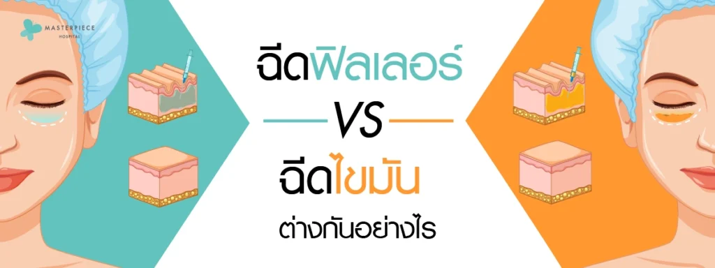 ฉีดฟิลเลอร์ vs ฉีดไขมันต่างกันอย่างไร