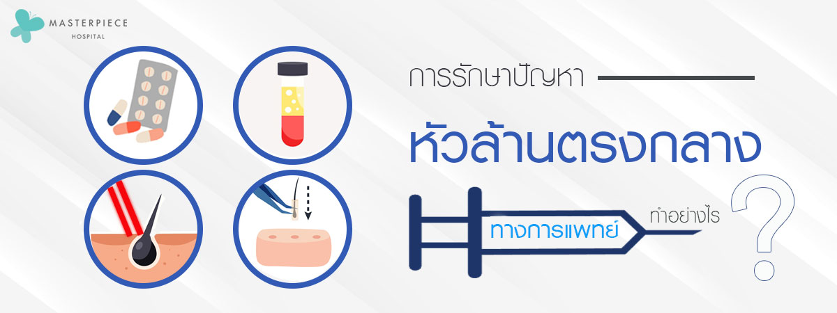 การรักษาปัญหาหัวล้านตรงกลางทางการแพทย์