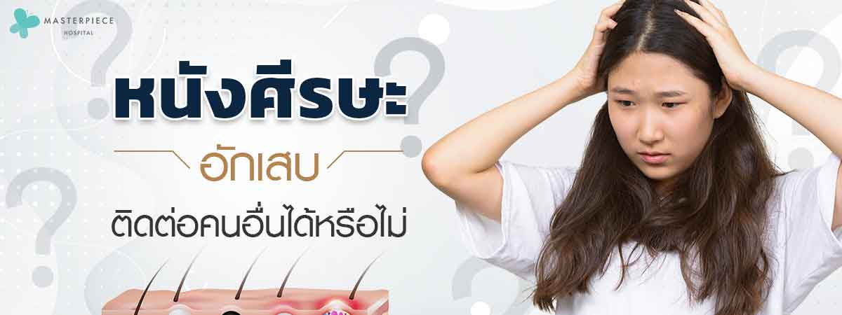 หนังศีรษะอักเสบไม่สามารถไปติดต่อกับคนอื่นได้  ฉนั้นไม่ใช่โรคติดต่อ