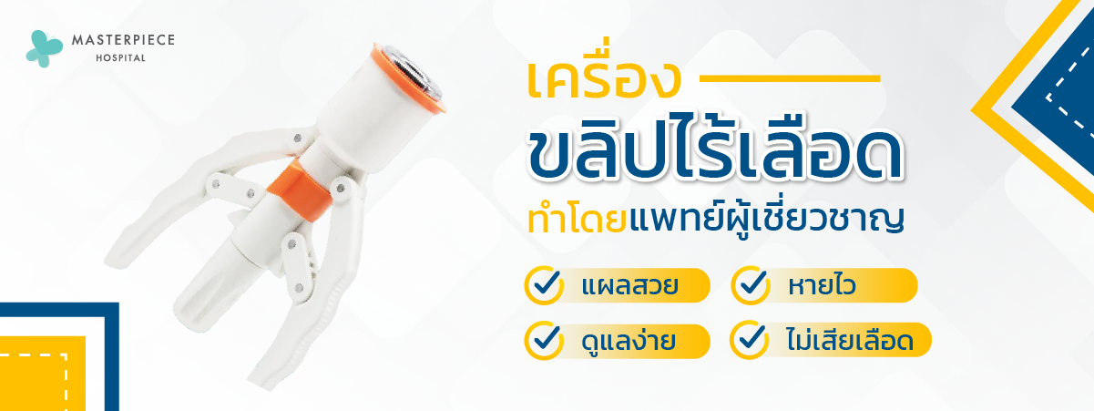 เครื่องขลิปไร้เลือด ทำโดยแพทย์ผู้เชี่ยวชาญ ที่โรงพยาบาลมาสเตอร์พีช