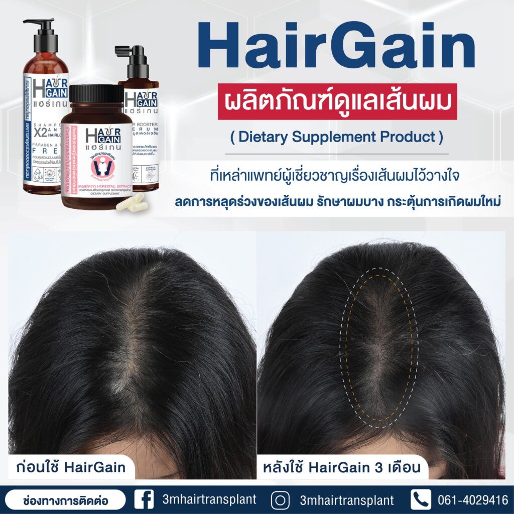 รีวิว HairGain ผลิตภัณฑ์ดูแลเส้นผมหลังใช้ต่อเนื่องกัน 3 เดือน