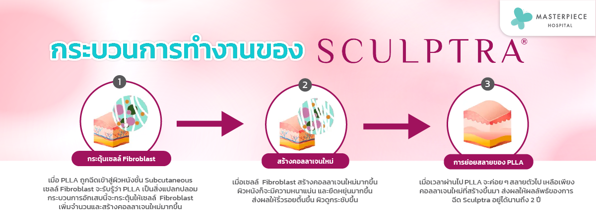 กระบวนการทำงานของ Sculptra