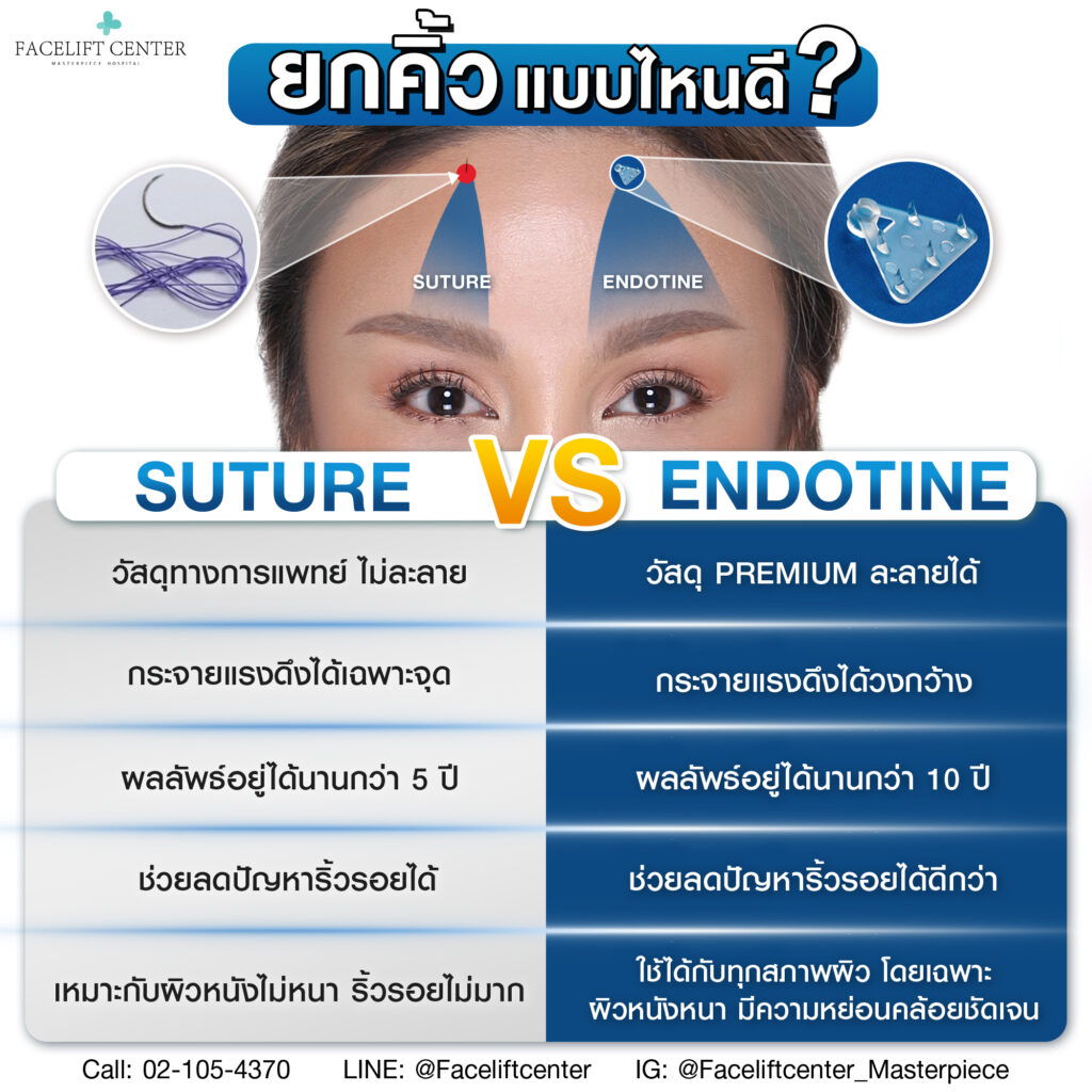 ยกคิ้วแบบไหนดี suture vs endotine