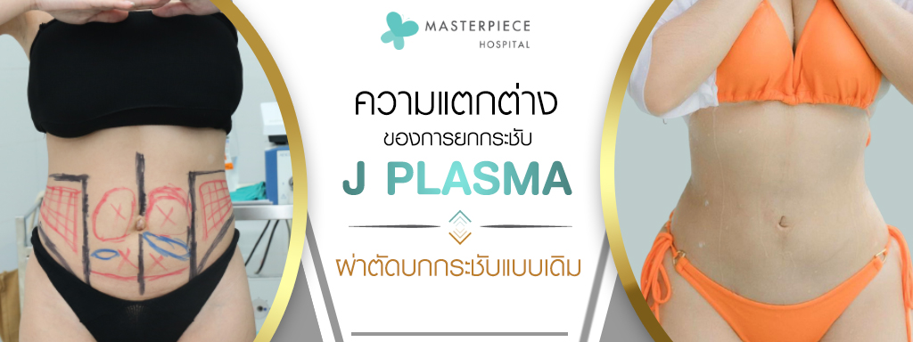 ความแตกต่างของการยกกระชับด้วย J PLASMA กับ การผ่าตัดยกกระชับแบบเดิม