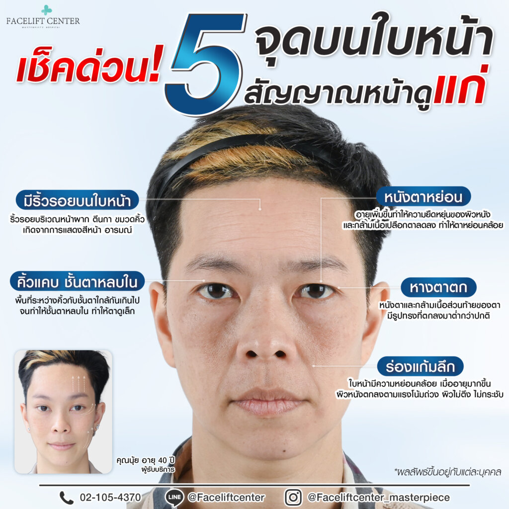 5 จุดบนใบหน้า สัญญาณหน้าดูแก่