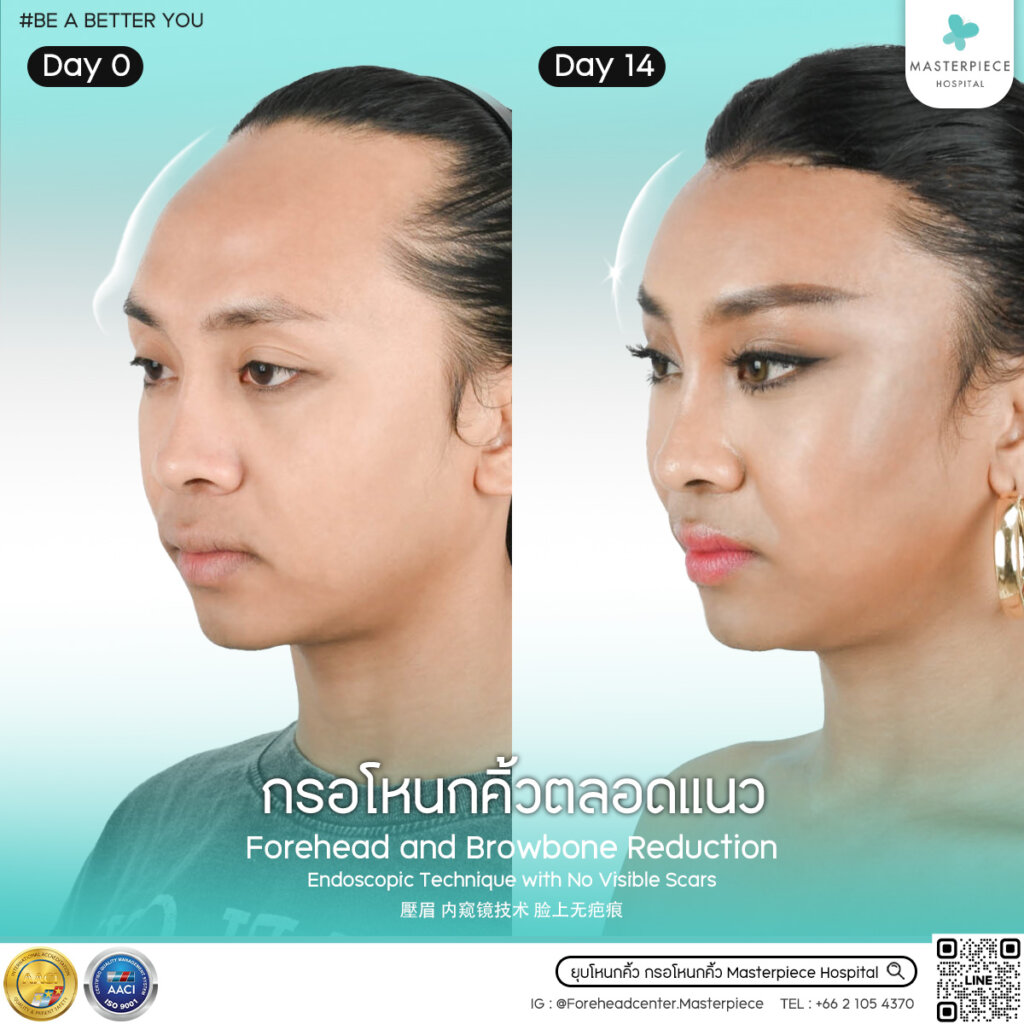 B&A กรอโหนกคิ้ว คุณKeydi be