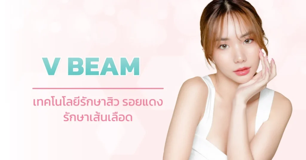 Laser V Beam เป็นเทคโนโลยีกำจัดรอยแดงบนใบหน้า ได้ผลดี ปลอดภัย