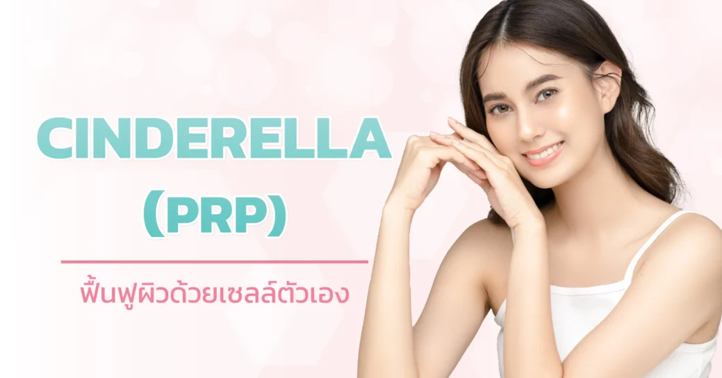 cinderella prp