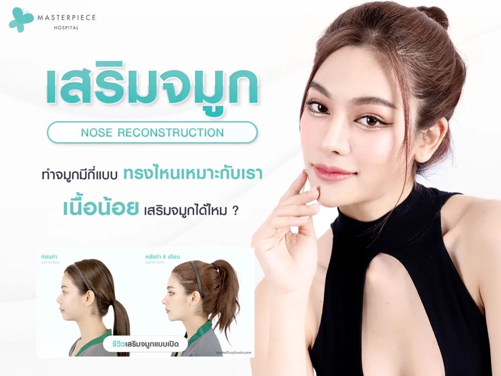 เสริมจมูก ทำจมูก ที่โรงพยาบาลมาสเตอร์พีช