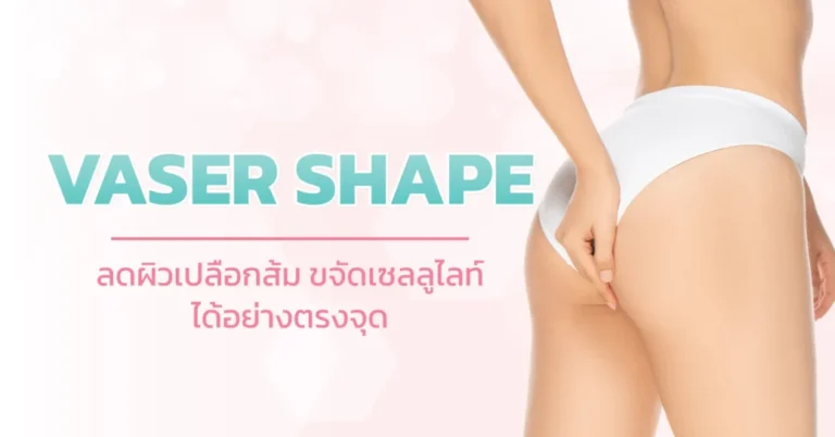 VASER SHAPE