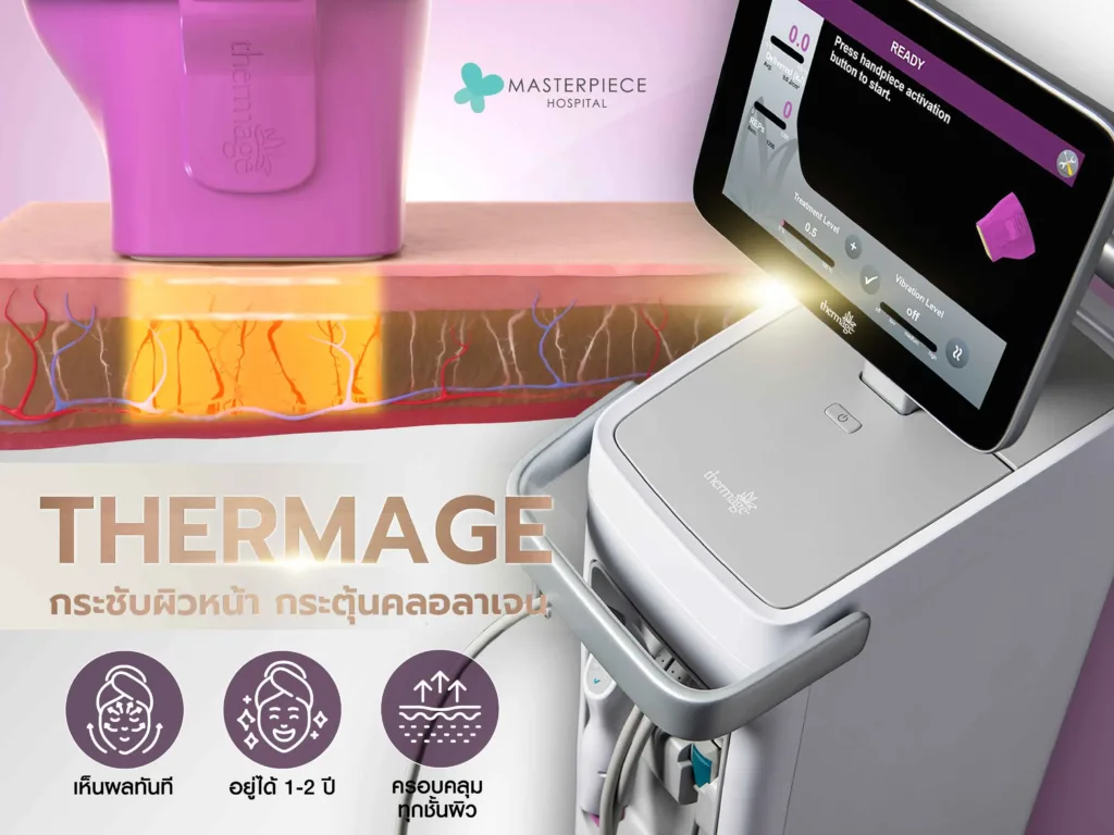 THERMAGE เลเซอร์ กระชับผิวหน้า กระตุ้นคลอลาเจน กระชับรูขุมขน