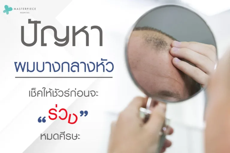 ผมบาง กลางหัว เช็คให้ชัวร์ก่อนผมร่วงหมดศีรษะ