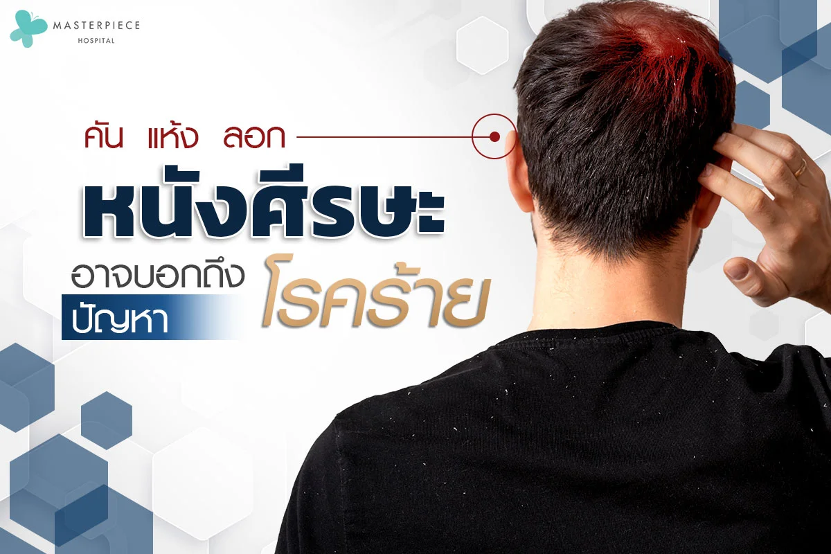 ปัญหาหนังศีรษะคันแห้งลอกอาจบอกถึงโรคร้าย