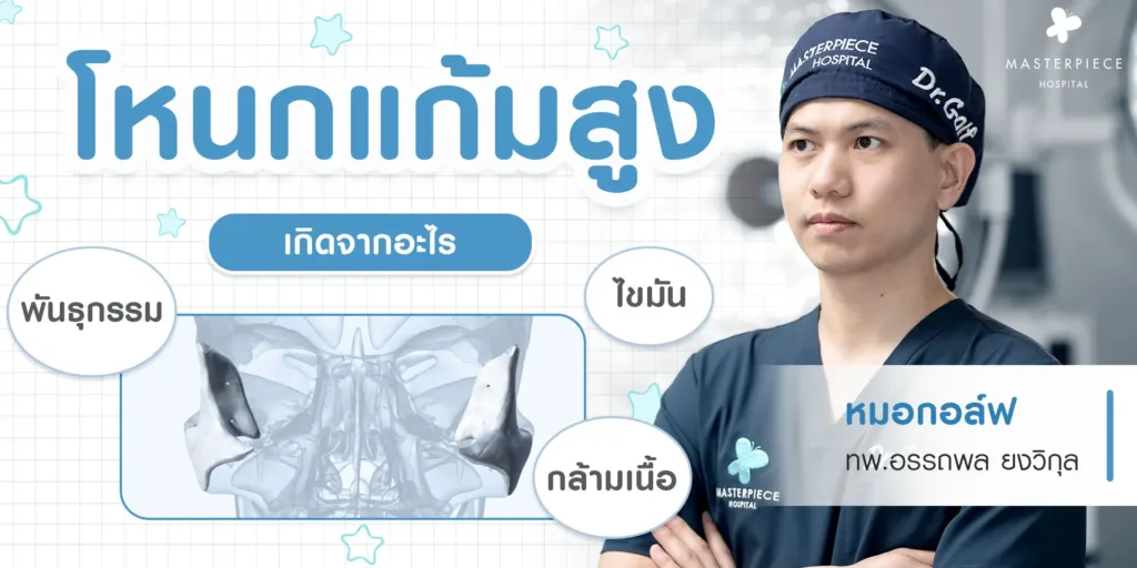 โหนกแก้มสูง เกิดจากอะไร