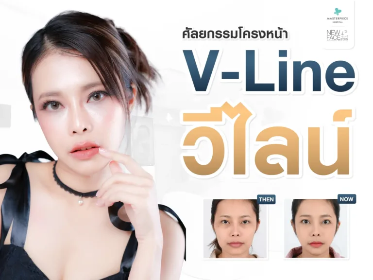 วีไลน์ V line ปรับโครงหน้า 3 จุด