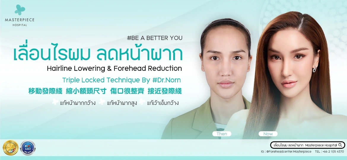 บริการเลื่อนไรผม ลดหน้าผาก โรงพบาลมาสเตอร์พีช