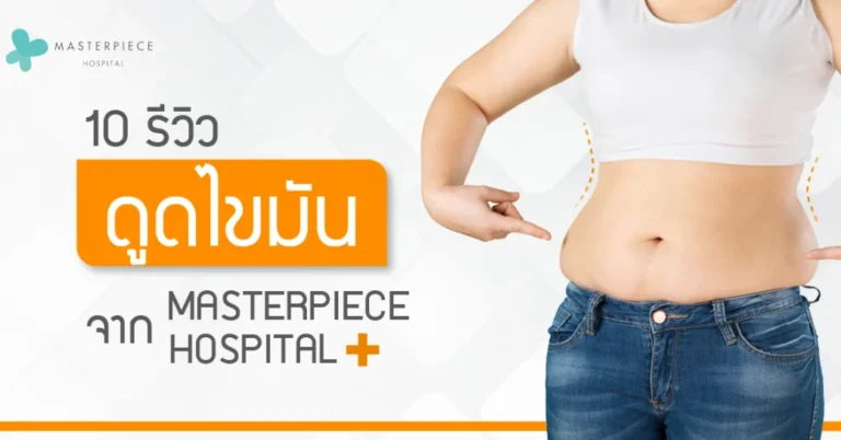 รวม 10 รีวิวดูดไขมัน สุดฮ็อต! จาก MASTERPIECE HOSPITAL