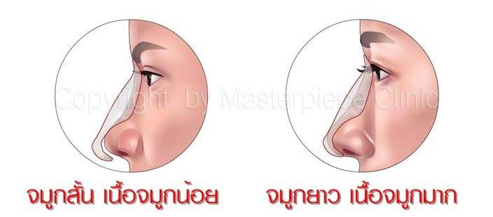 การที่ไม่รู้ว่าต้องใช้ซิลิโคนแบบไหน เหมาะแบบไหน โดยที่ทำไปโดยไม่เหมาะก็อาจจะทำให้พลาดได้