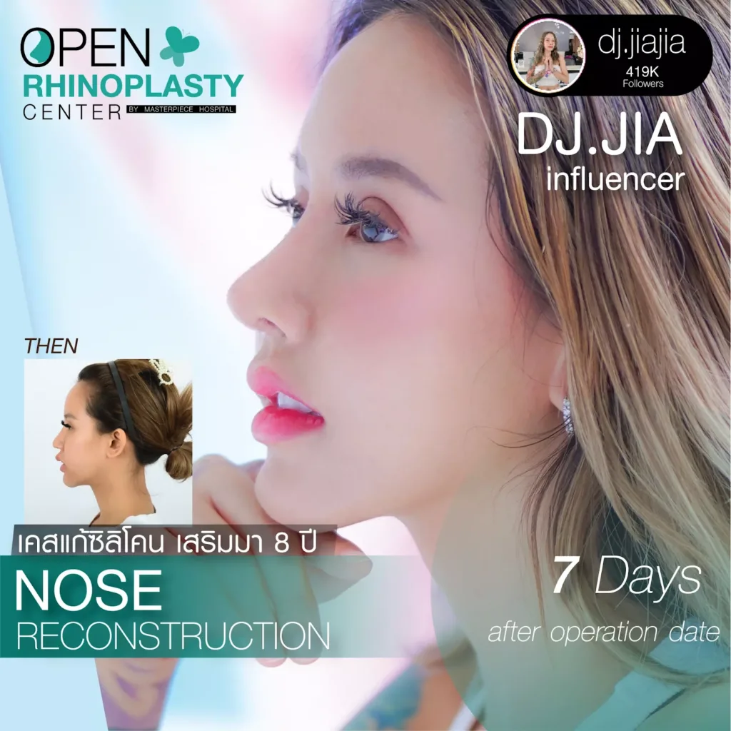 NoseCorrectionSurgery2