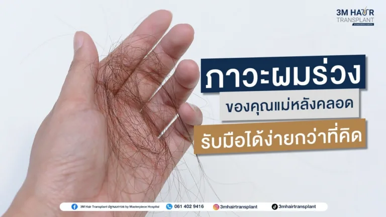 ภาวะผมร่วงของคุณแม่หลังคลอด รับมือได้ง่ายกว่าที่คิด