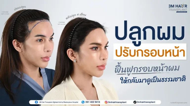 ปลูกผมปรับกรอบหน้า ฟื้นฟูกรอบหน้าผมให้กลับดูเป็นธรรมชาติ