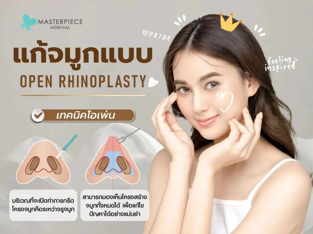 openrhinoplastycorrection