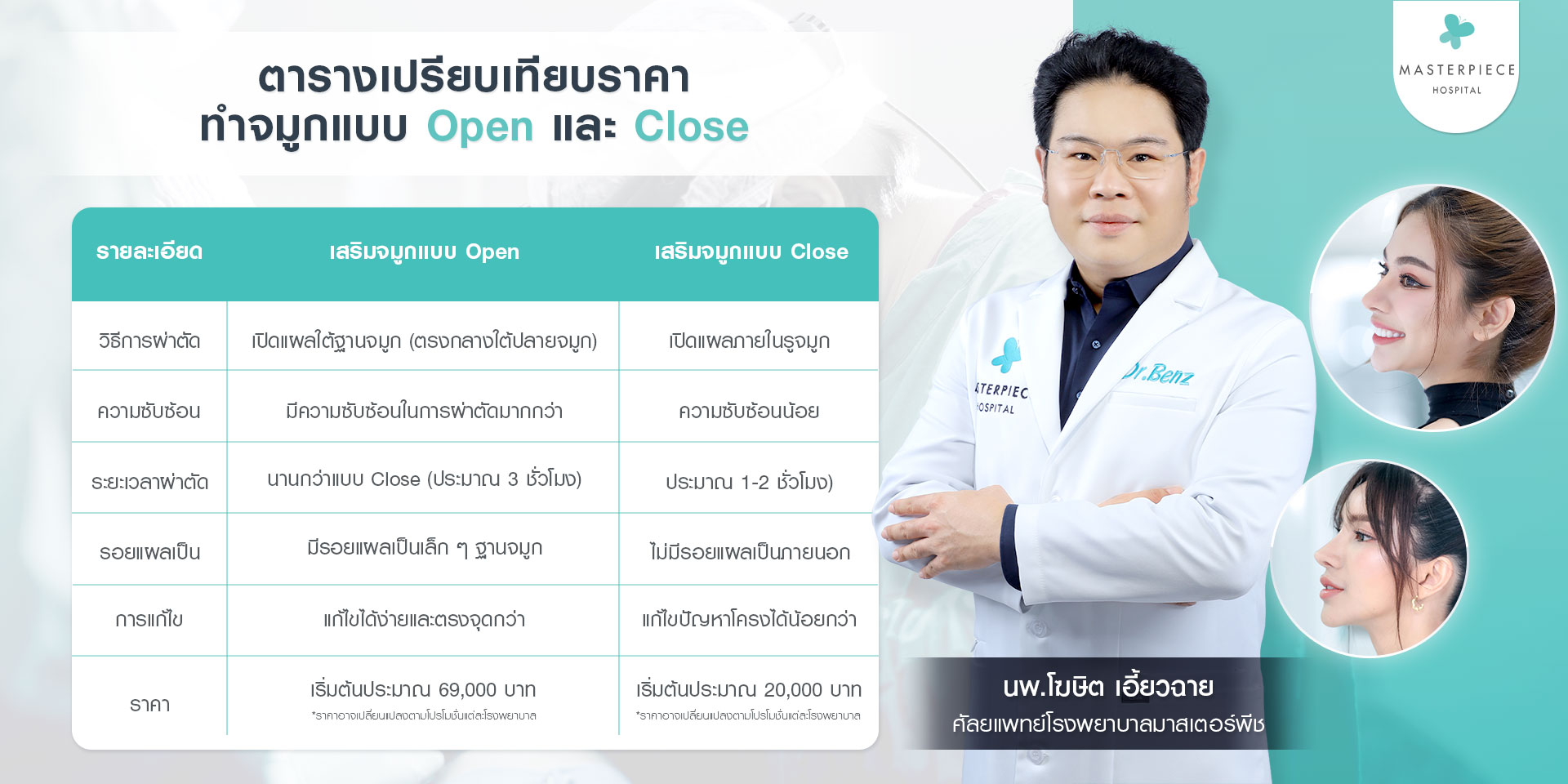 หมอเบนซ์ศัลยแพทย์ตกแต่งจมูกประโรงพยาบาลมาสเตอร์พีช กับ ตารางเปรียบเทียบราคาทำจมูกแบบ Open และ Close