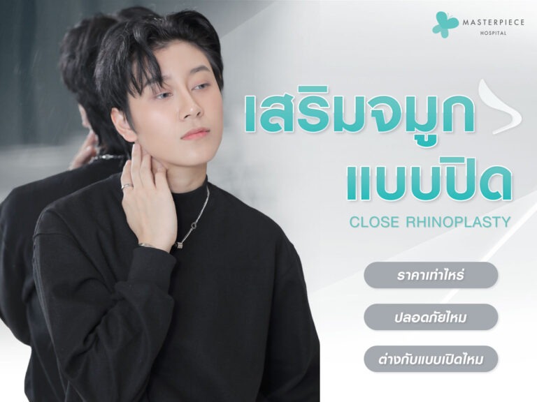 เสริมจมูกแบบปิดคืออะไร มีขั้นตอนอย่างไร มีข้อดีอะไรบ้าง