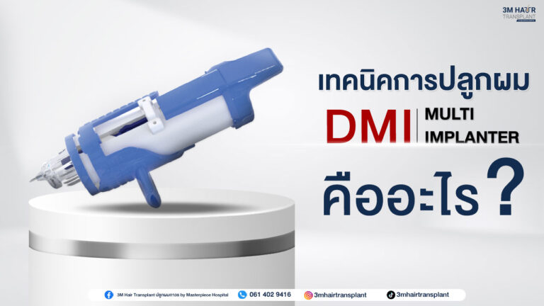 เทคนิคการปลูกผม DMI คืออะไร