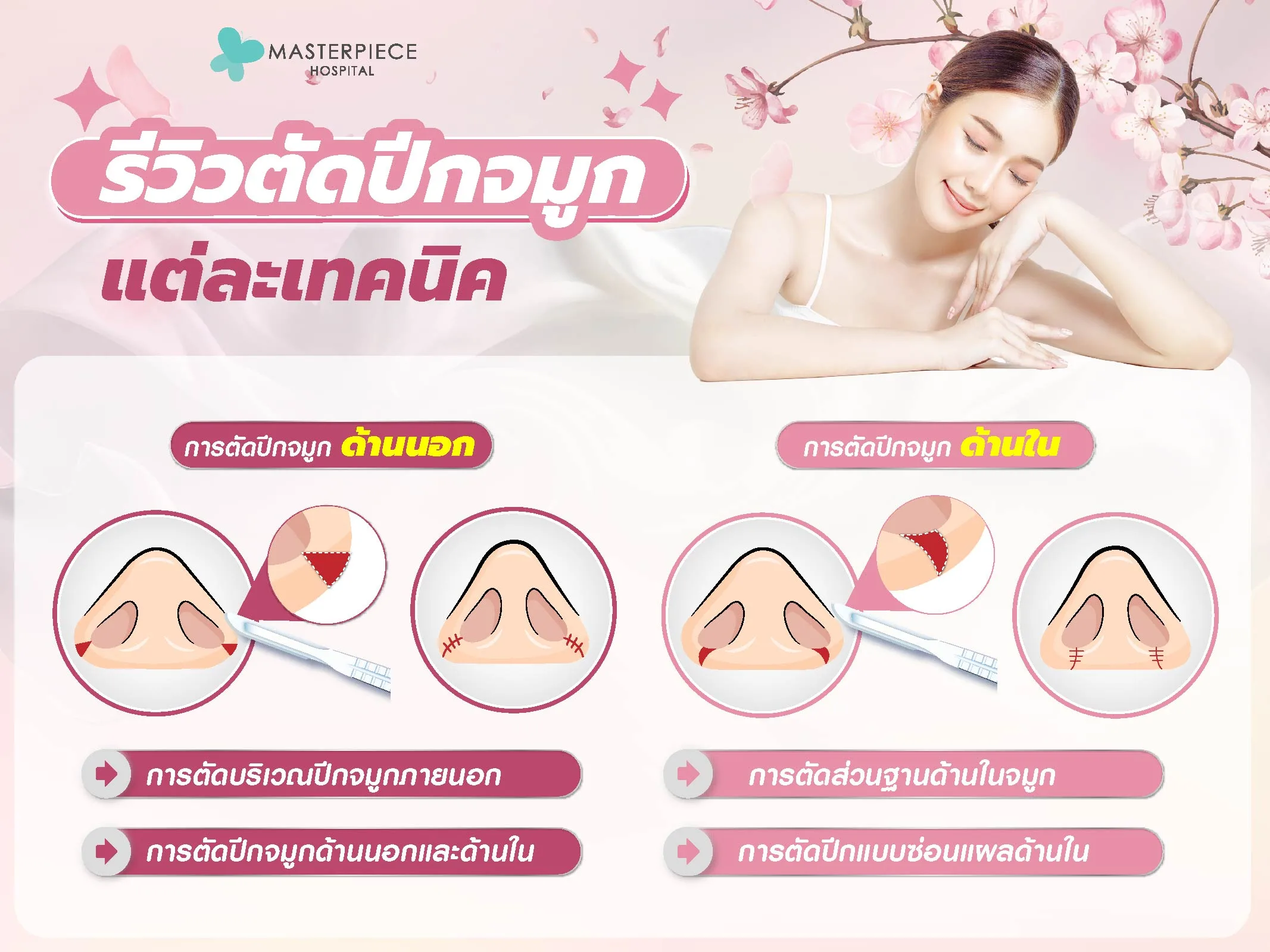 รีวิวตัดปีกจมูกแต่ละเทตนิค