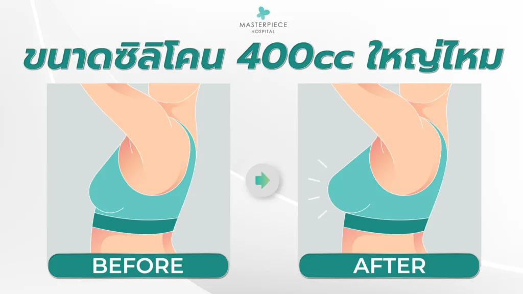 ขนาดซิลิโคน 400 cc ใหญ่ไหม