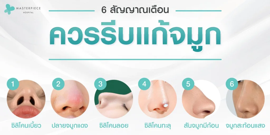 6-สัญญาณแก้จมูก มีซิลิโคนเบี้ยว ปลายจมูกแดง ซิลิโคนลอย ซิลิโคนทะลุ สันจมูกมีก้อน จมูกสะท้อนแสง