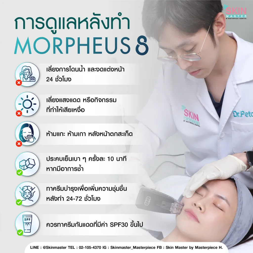 การดูแลหลังทำ มอเฟียส 8 ( MORPHEUS8 ) 