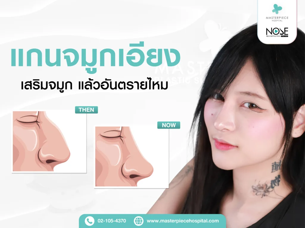 แกนจมูกเอียง เสริมจมูกแล้วอันตรายไหม