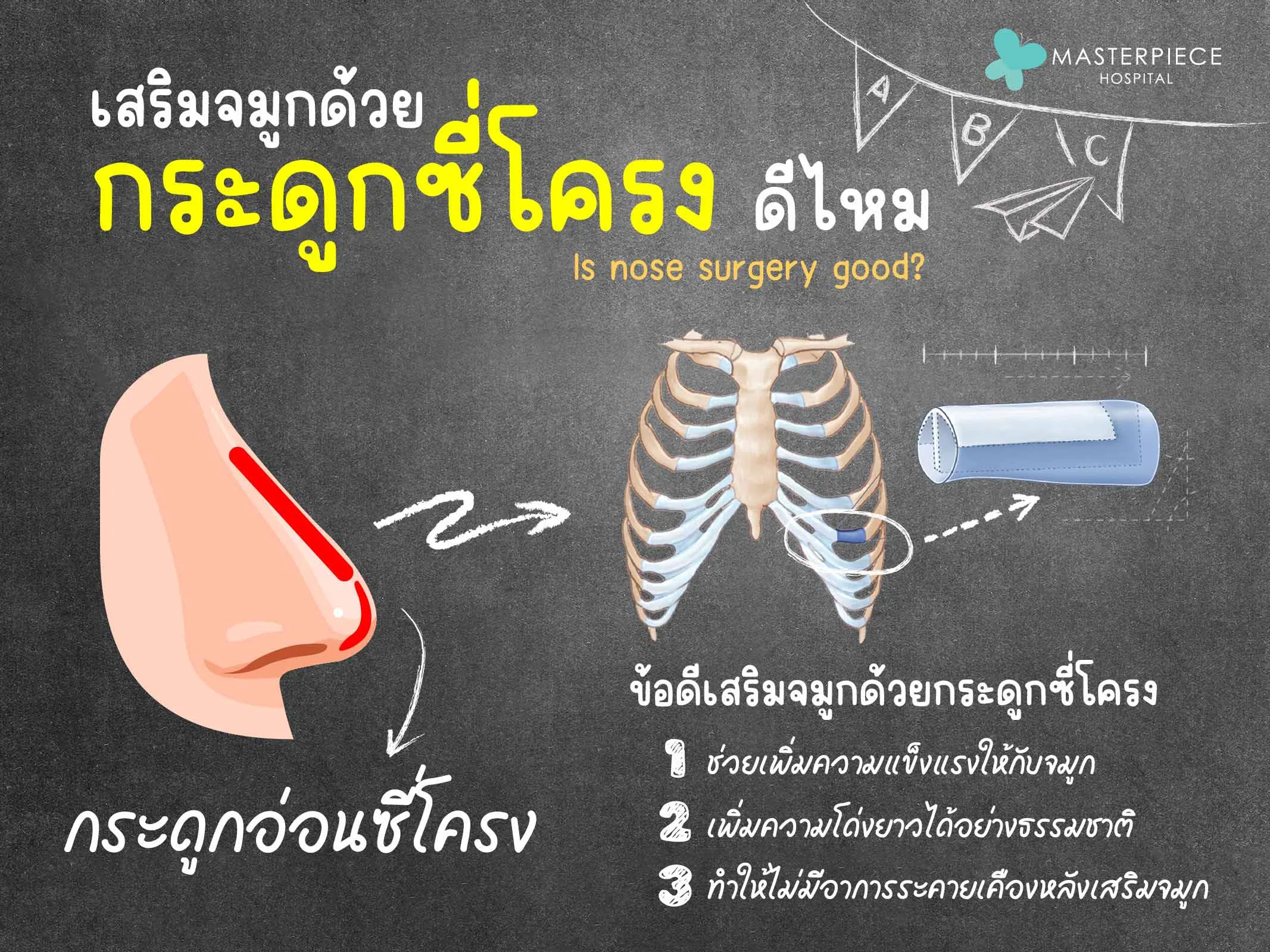 เสริมจมูกด้วยกระดูกซี่โตรงดีไหม