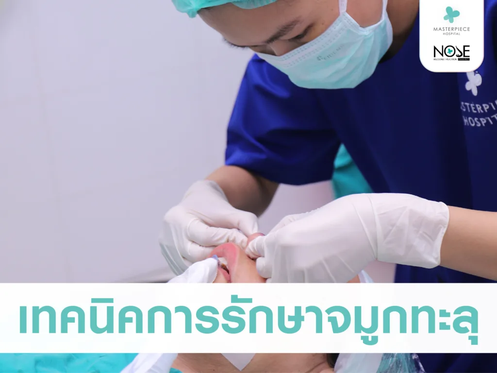 เทคนิควิธีรักษาจมูกทะลุ