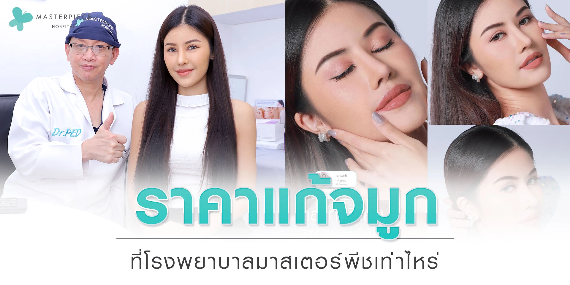 ราคาแก้จมูกที่โรงพยาบาลมาสเตอร์พีชเท่าไหร่